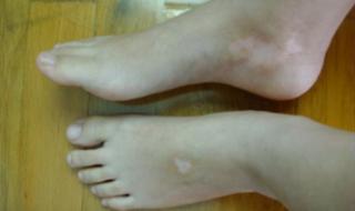 霰是大雪的前兆吗 下霰是什么征兆