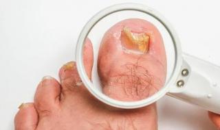 显微镜要多少钱 显微镜要多少钱